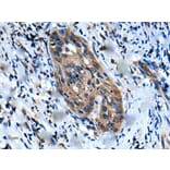 UBR2 Antibody from Signalway Antibody (43611) - Antibodies.com