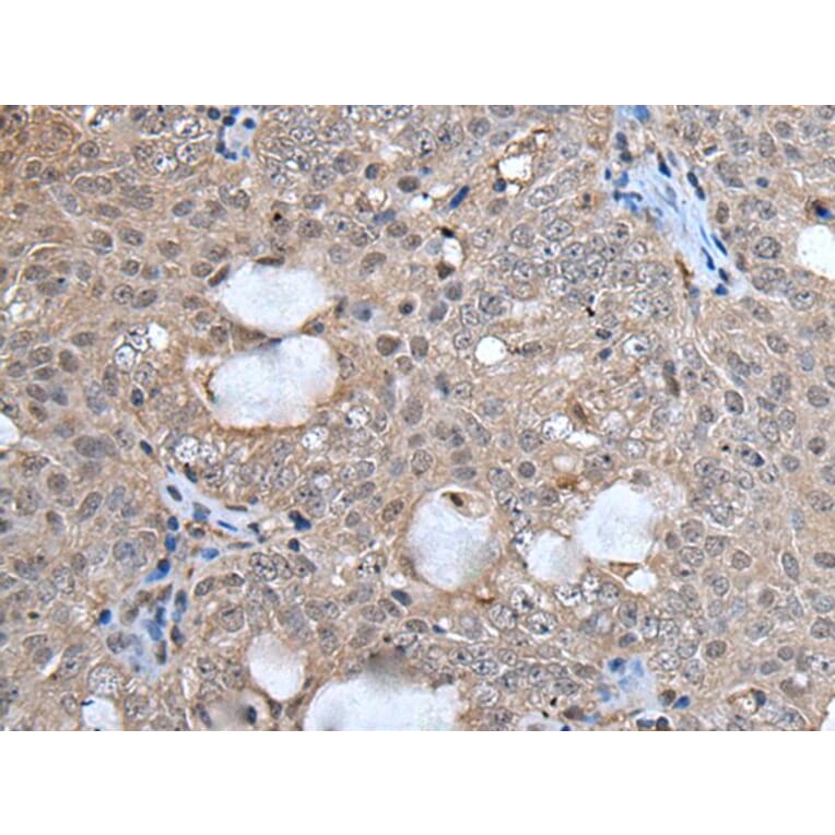 UFM1 Antibody from Signalway Antibody (43613) - Antibodies.com