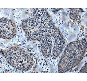 ULK4 Antibody from Signalway Antibody (43614) - Antibodies.com