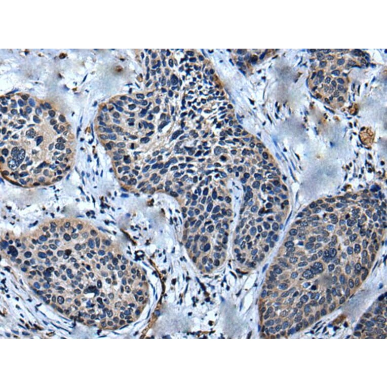 ULK4 Antibody from Signalway Antibody (43614) - Antibodies.com