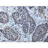 ULK4 Antibody from Signalway Antibody (43614) - Antibodies.com