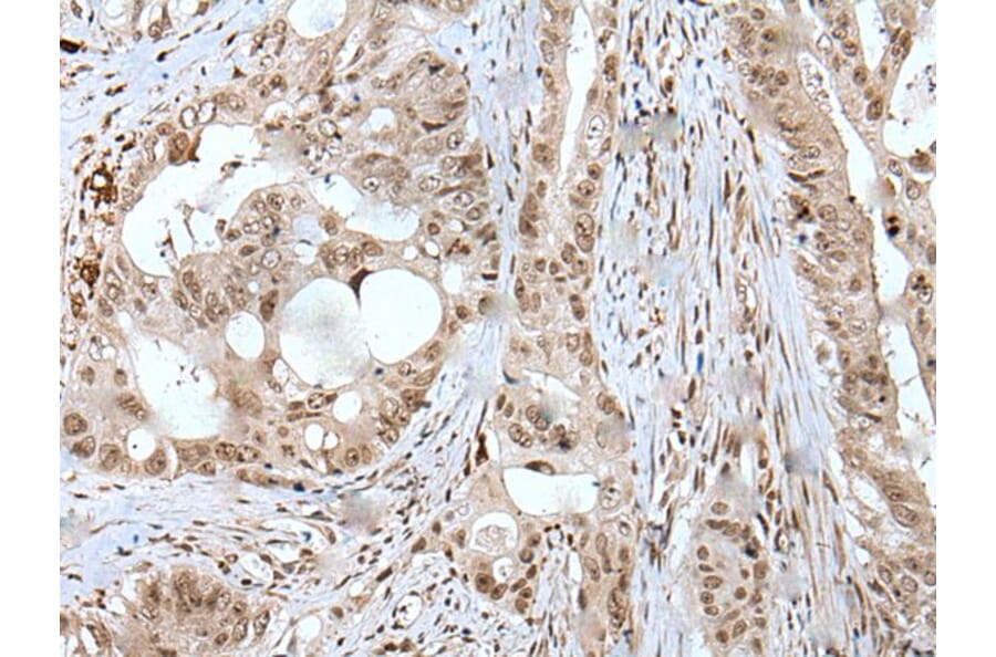 USP3 Antibody from Signalway Antibody (43620) - Antibodies.com