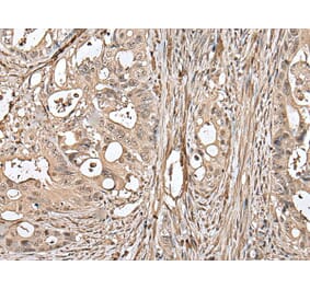 UTP3 Antibody from Signalway Antibody (43621) - Antibodies.com