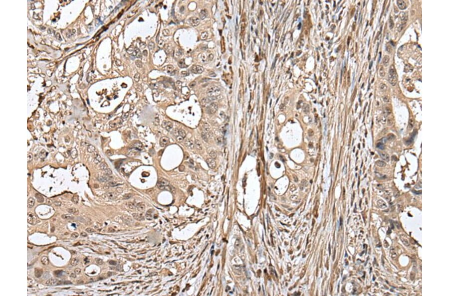 UTP3 Antibody from Signalway Antibody (43621) - Antibodies.com