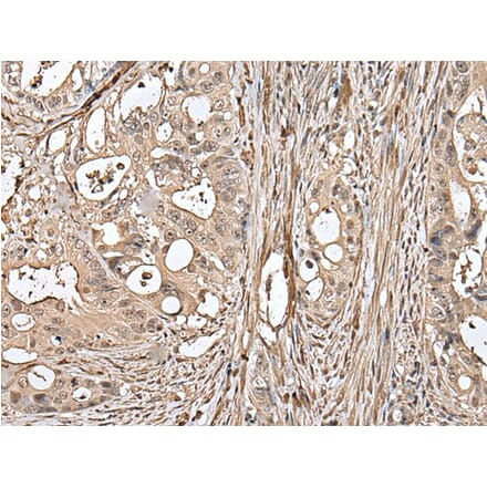 UTP3 Antibody from Signalway Antibody (43621) - Antibodies.com