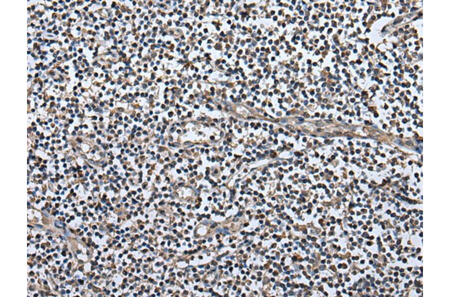 UTP3 Antibody from Signalway Antibody (43621) - Antibodies.com