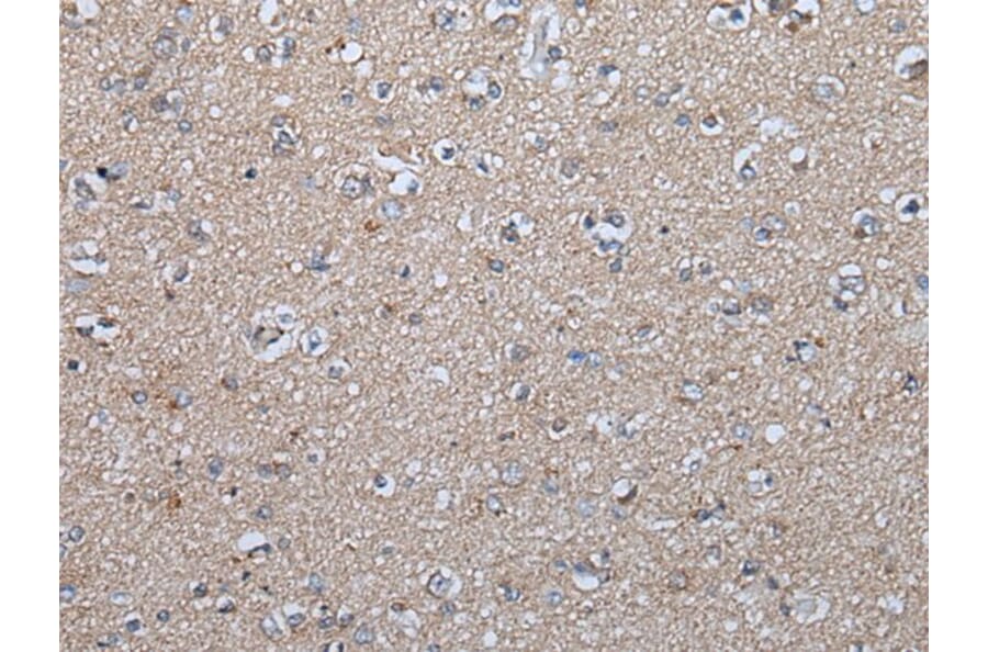 FGF5 Antibody from Signalway Antibody (43624) - Antibodies.com