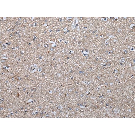 FGF5 Antibody from Signalway Antibody (43624) - Antibodies.com