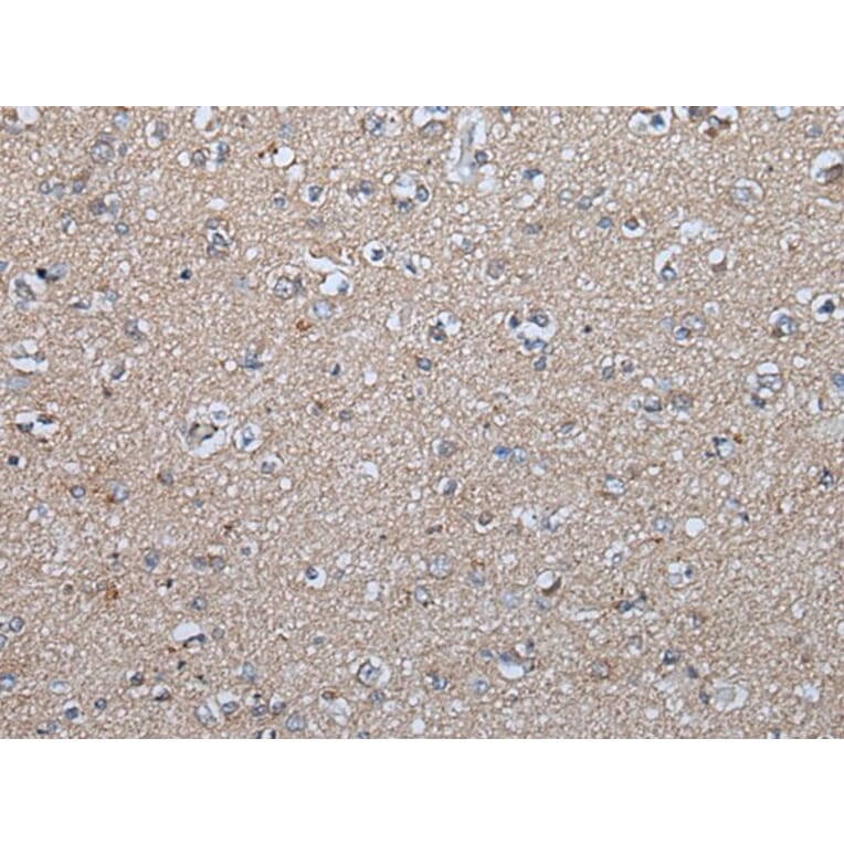 FGF5 Antibody from Signalway Antibody (43624) - Antibodies.com