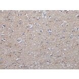 FGF5 Antibody from Signalway Antibody (43624) - Antibodies.com