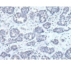 RARG Antibody from Signalway Antibody (43631) - Antibodies.com