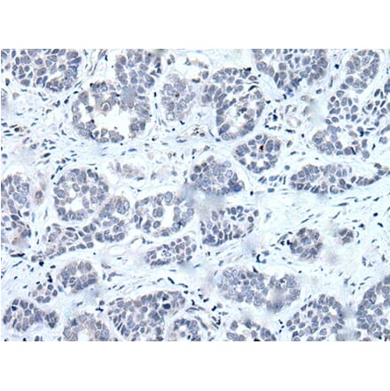 RARG Antibody from Signalway Antibody (43631) - Antibodies.com