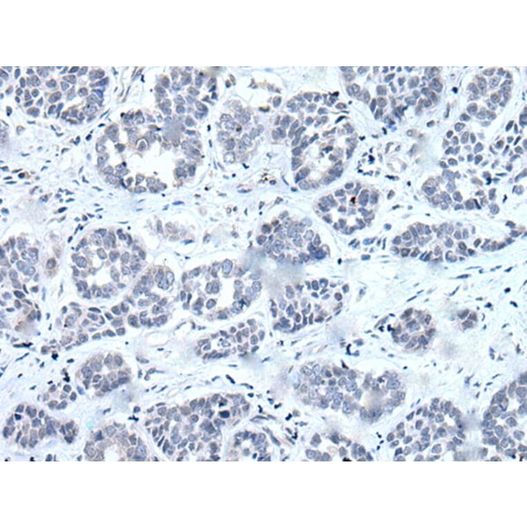 RARG Antibody from Signalway Antibody (43631) - Antibodies.com