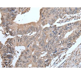 SMC5 Antibody from Signalway Antibody (43637) - Antibodies.com