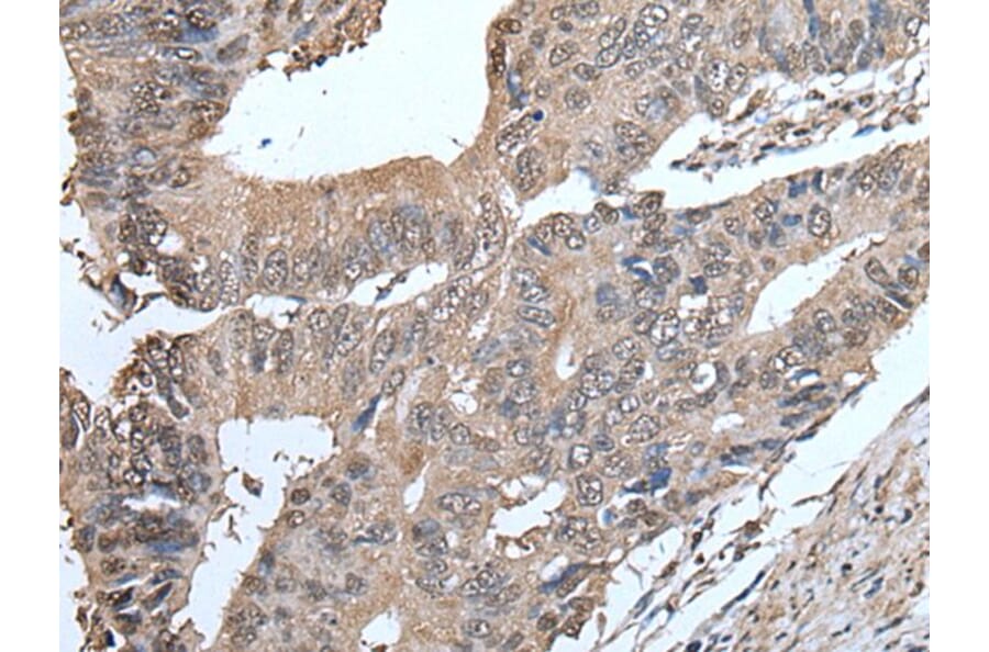 SMC5 Antibody from Signalway Antibody (43637) - Antibodies.com