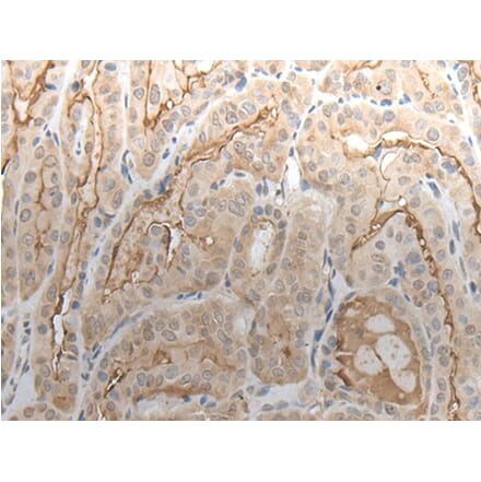VAV3 Antibody from Signalway Antibody (43646) - Antibodies.com