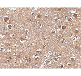 WAPL Antibody from Signalway Antibody (43647) - Antibodies.com