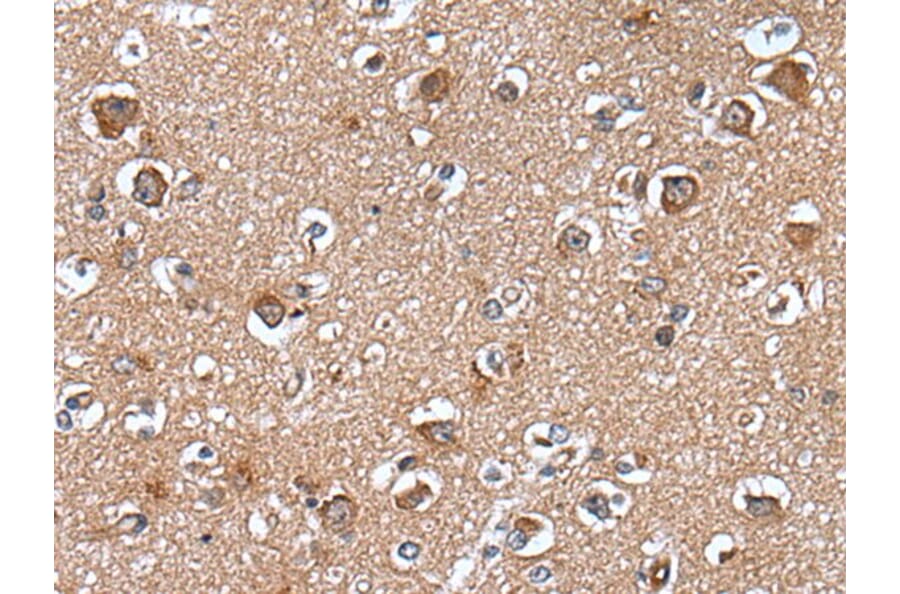 WAPL Antibody from Signalway Antibody (43647) - Antibodies.com