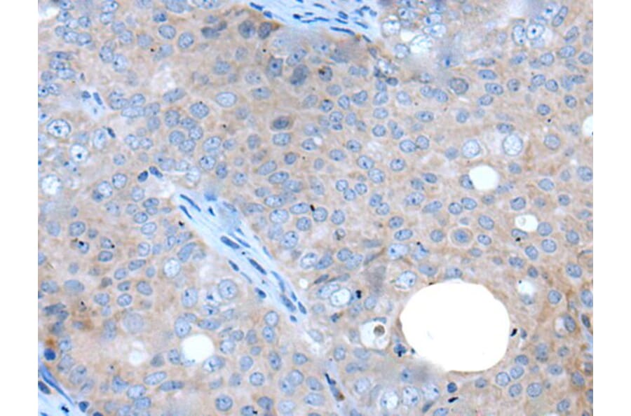 WAPL Antibody from Signalway Antibody (43647) - Antibodies.com