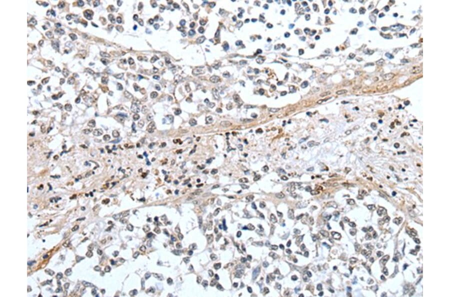 XAF1 Antibody from Signalway Antibody (43649) - Antibodies.com
