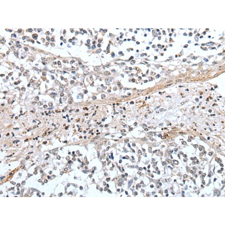 XAF1 Antibody from Signalway Antibody (43649) - Antibodies.com