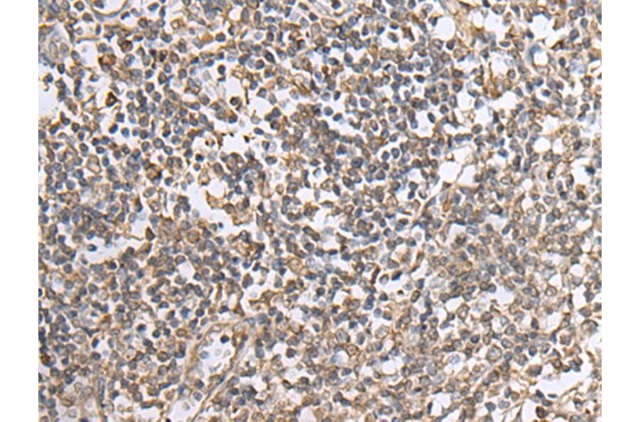 NTN1 Antibody from Signalway Antibody (43661) - Antibodies.com