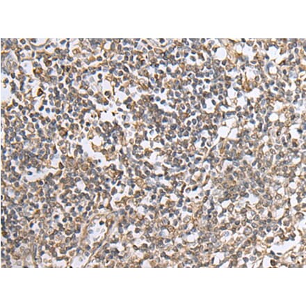 NTN1 Antibody from Signalway Antibody (43661) - Antibodies.com