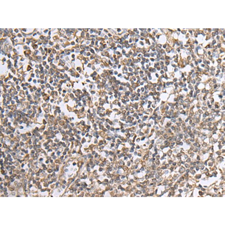 NTN1 Antibody from Signalway Antibody (43661) - Antibodies.com