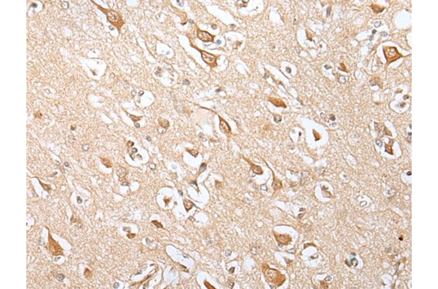 E2F3 Antibody from Signalway Antibody (43667) - Antibodies.com