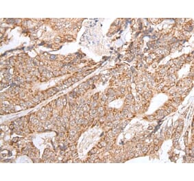 GNLY Antibody from Signalway Antibody (43674) - Antibodies.com