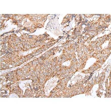 GNLY Antibody from Signalway Antibody (43674) - Antibodies.com