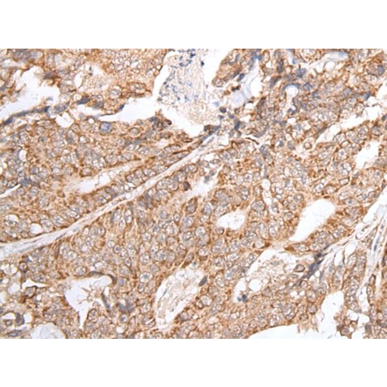 GNLY Antibody from Signalway Antibody (43674) - Antibodies.com