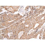 GNLY Antibody from Signalway Antibody (43674) - Antibodies.com