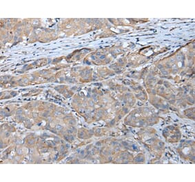 GPC5 Antibody from Signalway Antibody (43675) - Antibodies.com