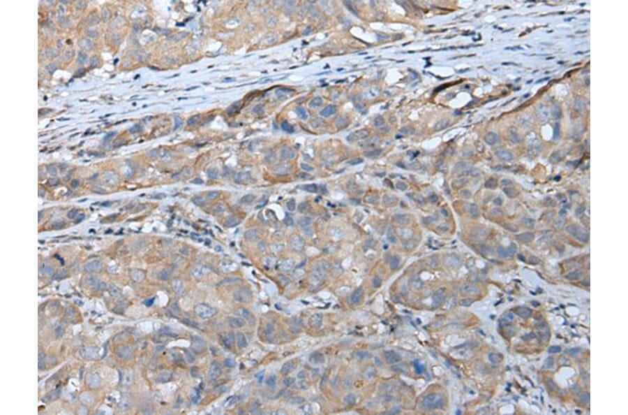 GPC5 Antibody from Signalway Antibody (43675) - Antibodies.com
