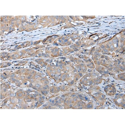 GPC5 Antibody from Signalway Antibody (43675) - Antibodies.com