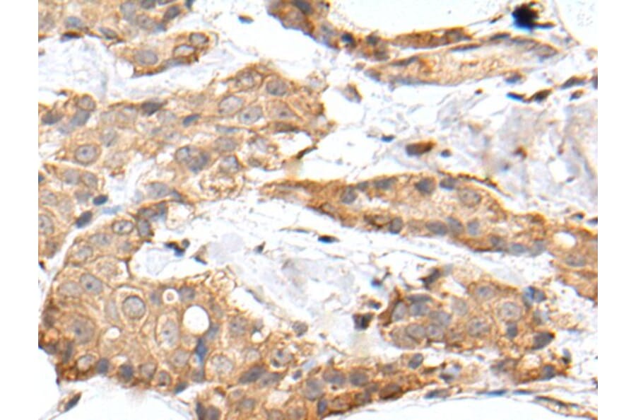 GRM4 Antibody from Signalway Antibody (43678) - Antibodies.com