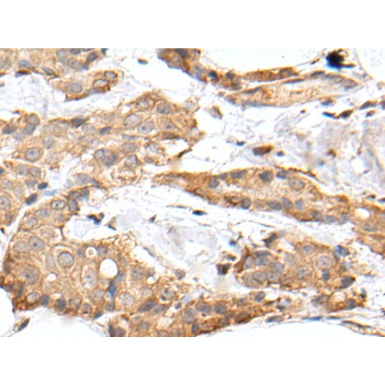 GRM4 Antibody from Signalway Antibody (43678) - Antibodies.com