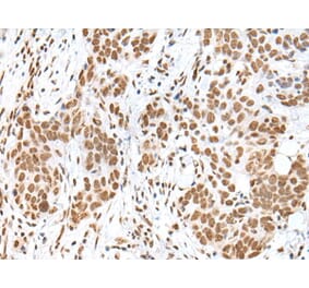 HCN3 Antibody from Signalway Antibody (43682) - Antibodies.com