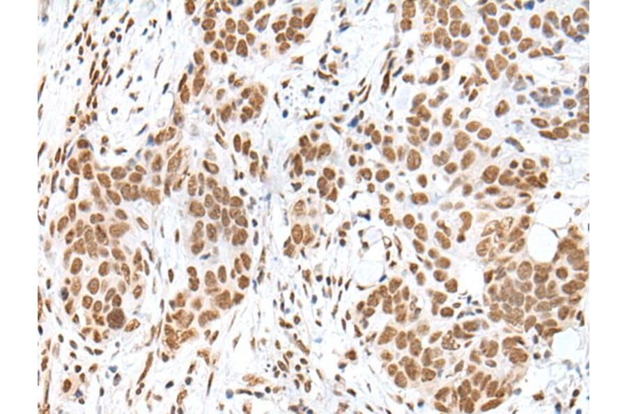 HCN3 Antibody from Signalway Antibody (43682) - Antibodies.com