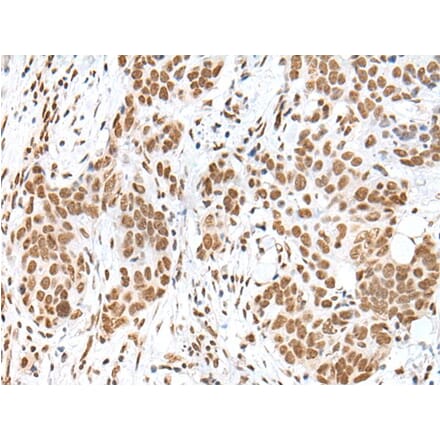 HCN3 Antibody from Signalway Antibody (43682) - Antibodies.com