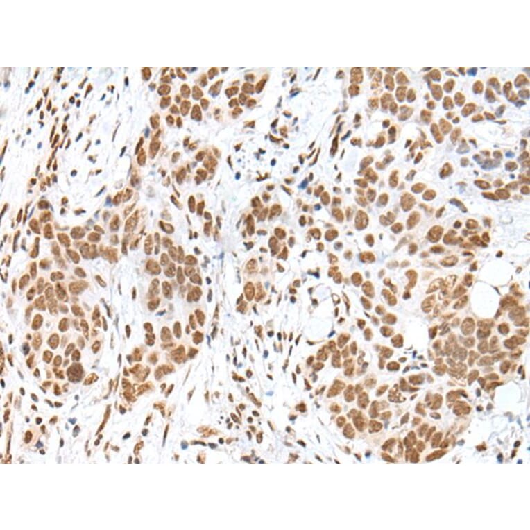 HCN3 Antibody from Signalway Antibody (43682) - Antibodies.com