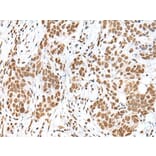 HCN3 Antibody from Signalway Antibody (43682) - Antibodies.com