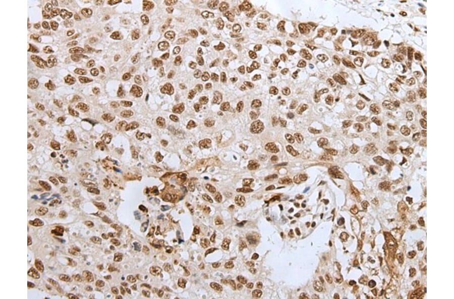 HCN3 Antibody from Signalway Antibody (43682) - Antibodies.com