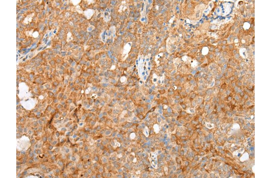 SDC2 Antibody from Signalway Antibody (43692) - Antibodies.com