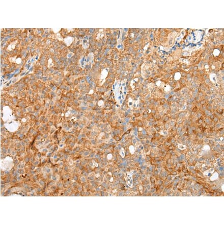 SDC2 Antibody from Signalway Antibody (43692) - Antibodies.com