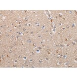 TNIK Antibody from Signalway Antibody (43698) - Antibodies.com