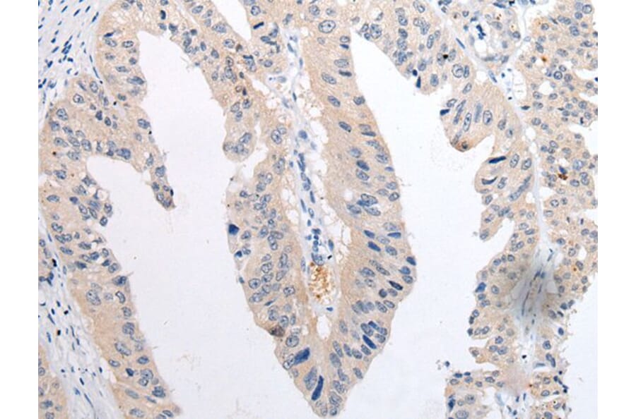 TNIK Antibody from Signalway Antibody (43698) - Antibodies.com