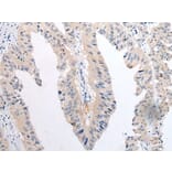 TNIK Antibody from Signalway Antibody (43698) - Antibodies.com