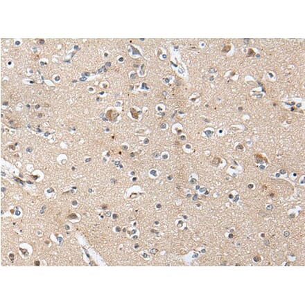 ACAN Antibody from Signalway Antibody (43699) - Antibodies.com